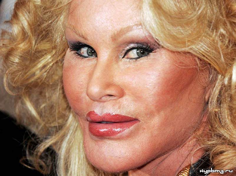 Жертвы, пластическая хирургия, шок , пластика