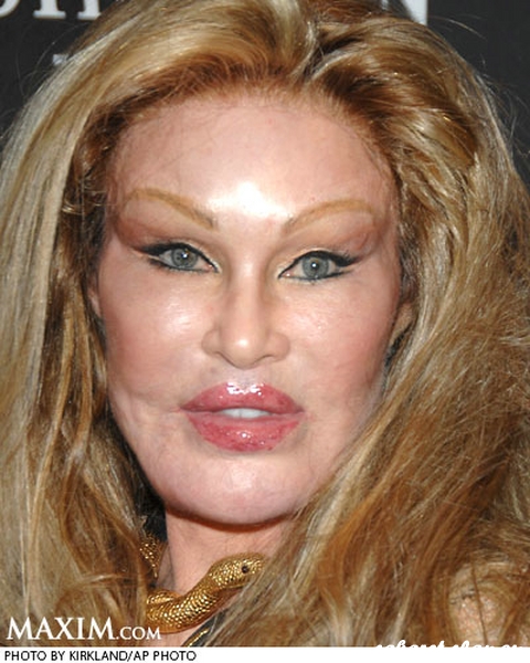 Жертвы, пластическая хирургия, шок , пластика