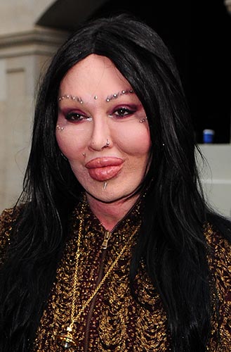 Жертвы, пластическая хирургия, шок , пластика