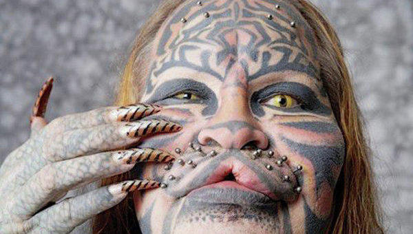 Жертвы, пластическая хирургия, шок , пластика