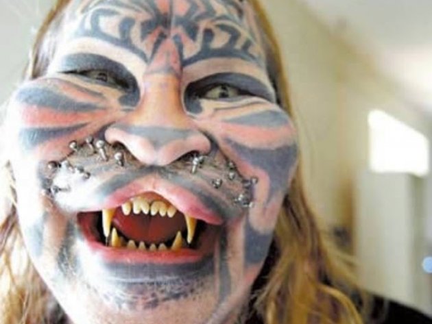 Жертвы, пластическая хирургия, шок , пластика