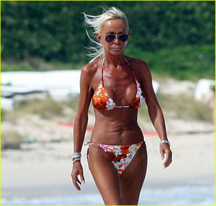 Жертвы, пластическая хирургия, шок , пластика