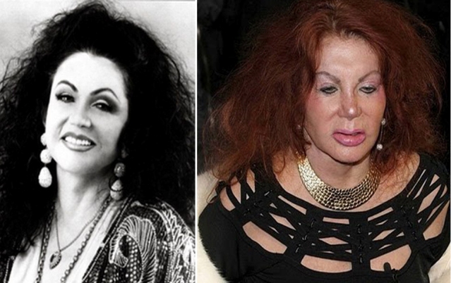 Жертвы, пластическая хирургия, шок , пластика