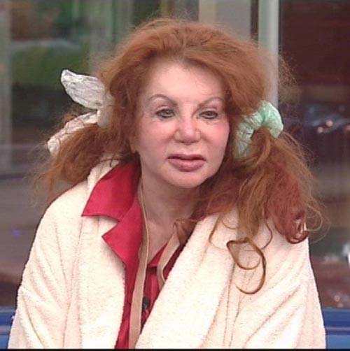 Жертвы, пластическая хирургия, шок , пластика