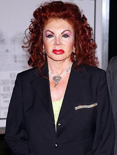 Жертвы, пластическая хирургия, шок , пластика