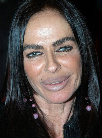 Жертвы, пластическая хирургия, шок , пластика