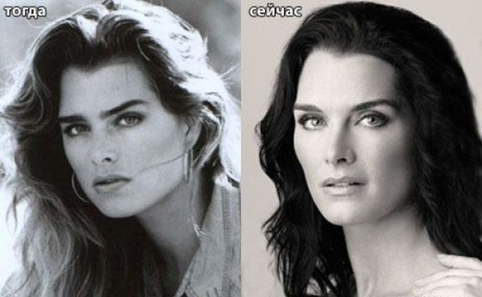 пластическая хирургия, тогда и сейчас 