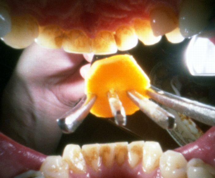 Фотографии из рта,фотопроект, фотограф, Джастин Куиннелл, Justin Quinnell