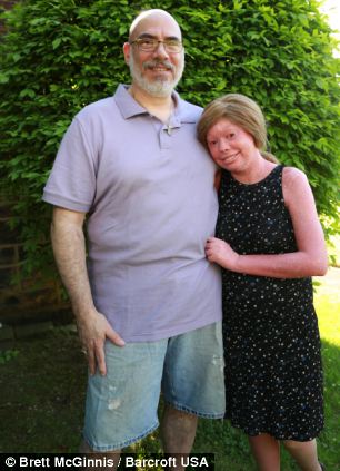 Хантер Стейниц, hunter steinitz, ихтиоз арлекина, болезнь