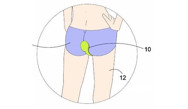нелепые, абсурдные, патенты, изобретения