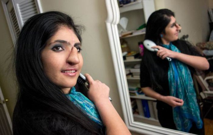 Всемирно известная Аиша с новым лицом Аиша Мухаммадзаи нос уши