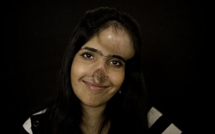 Всемирно известная Аиша с новым лицом Аиша Мухаммадзаи нос уши