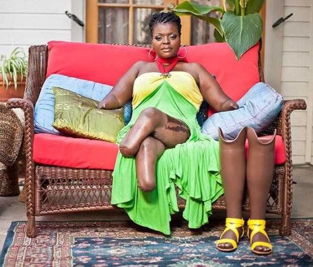 apryl michelle brown, Эйприл Мишель Браун, инвалид, силикон