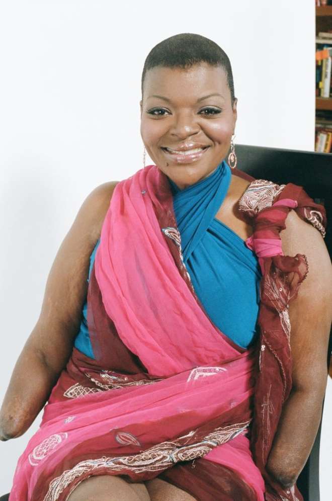 apryl michelle brown, Эйприл Мишель Браун, инвалид, силикон