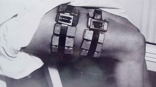 Пугающие медицинские инструменты прошлого, безумные инструменты прошлого 