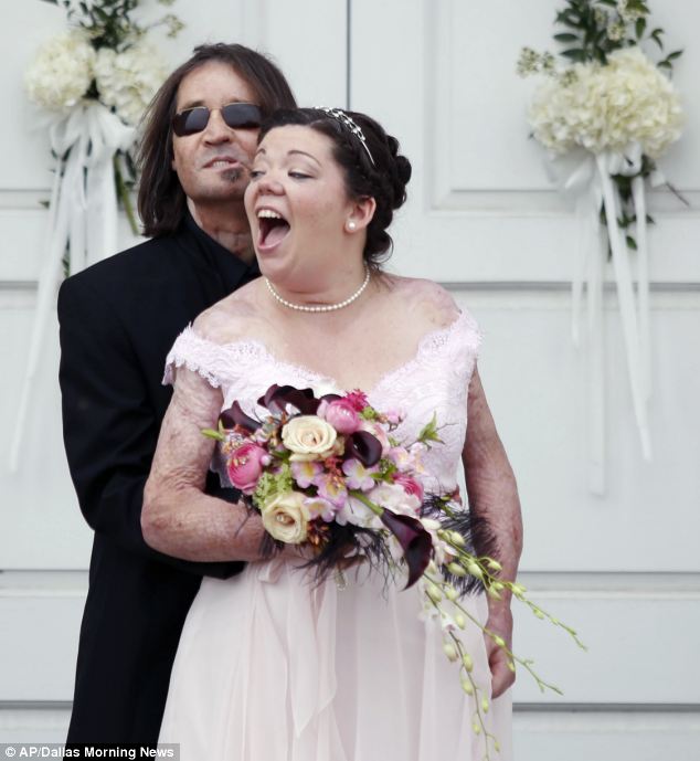 Человек без лица женился! Человек, без, лица, женился, Даллас, Винс, Нэш, ожог, удар током