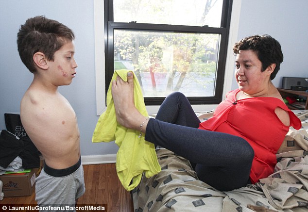 Мать и сын родились без рук, но это не мешает им чистить зубы, кушать и даже играть в компьютерные игры Мать и сын родились без рук, синдром Холта-Орама, родились без рук образ жизни