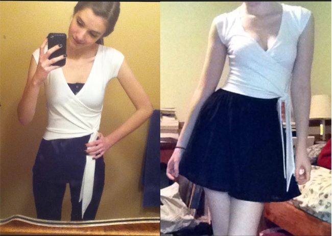 Истории девушек победивших анорексию, фотографии девушек анорексия до и после