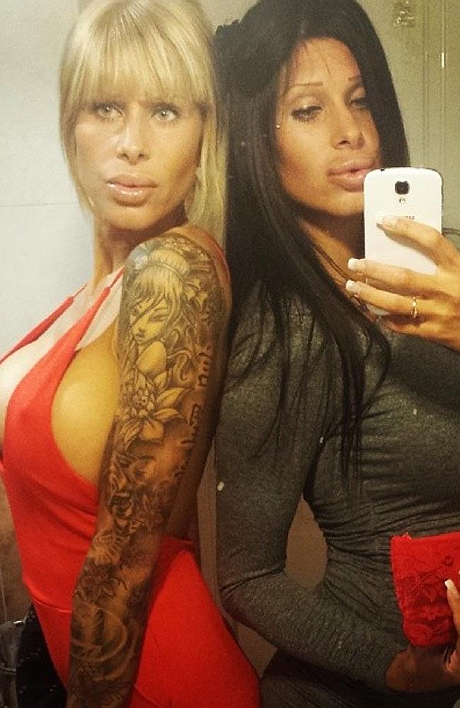 Emma and Sara Koponen, близняшки Сара и Эмма Копонен, близнецы пластические операции 