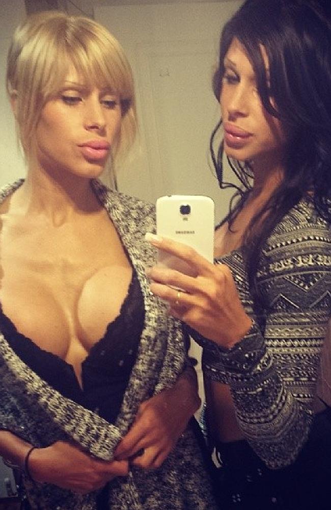 Emma and Sara Koponen, близняшки Сара и Эмма Копонен, близнецы пластические операции 