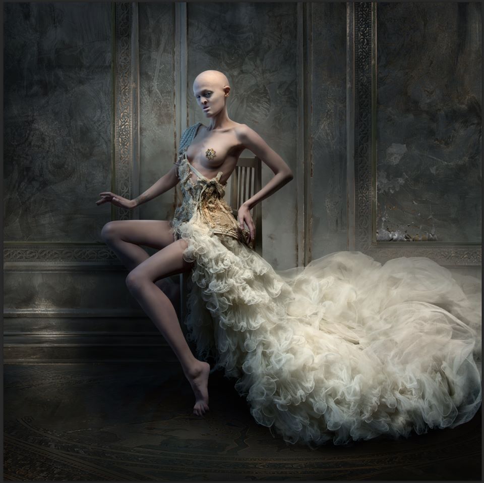 Мелани Гайдос Melanie Gaydos, эктодермальная дисплазия, модель с необычной внешностью,