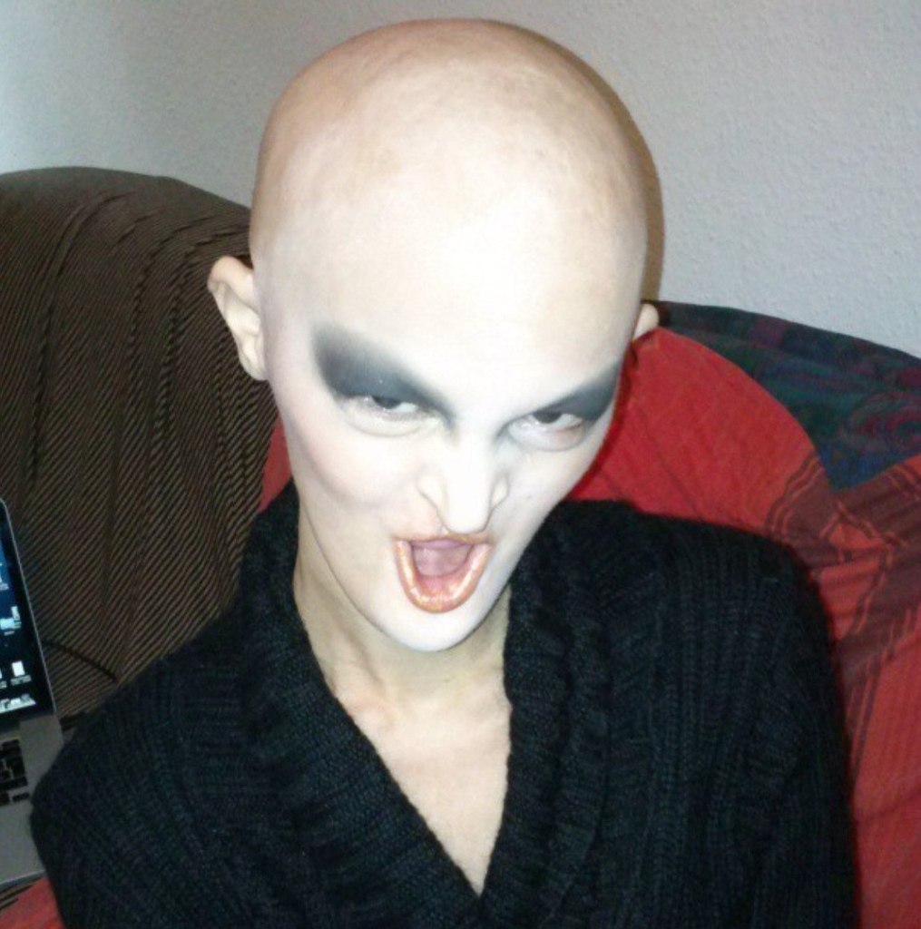 Мелани Гайдос Melanie Gaydos, эктодермальная дисплазия, модель с необычной внешностью,