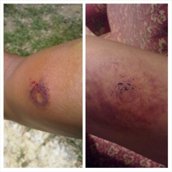 последствия игры в пейнтбол, что бывает после игры в пейнтбол