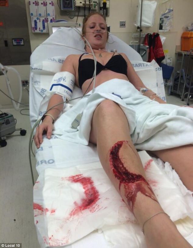 акула напала на девушку, укус акулы быка, акула-бык укусила девушку, акула на пляже, Джессика Вон