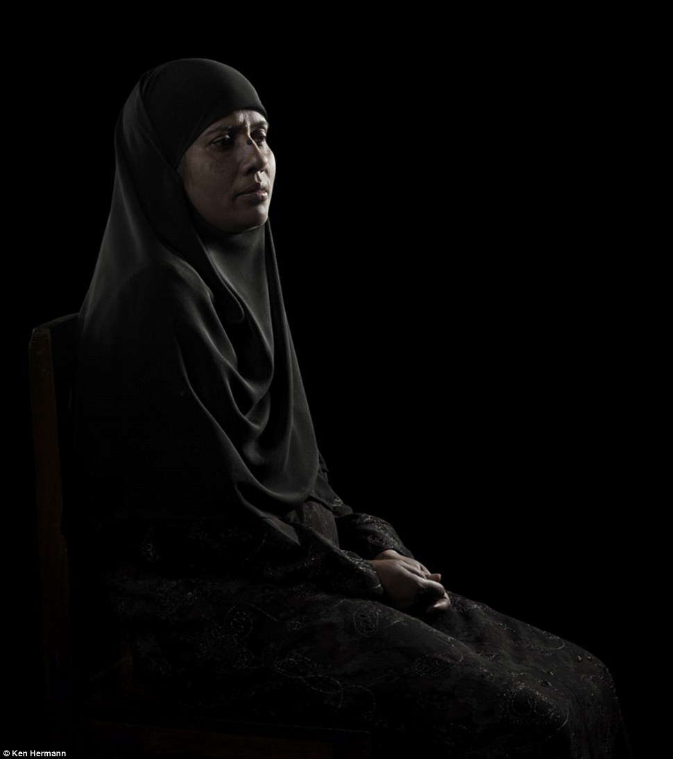 Жители Бангладеш, облитые кислотой, рассказывают о причинах своих ужасных увечий Бангладеш кислота, Кен Германн Ken Hermann, люди облитые кислотой