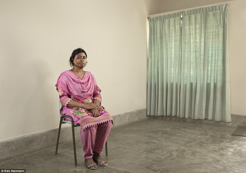 Жители Бангладеш, облитые кислотой, рассказывают о причинах своих ужасных увечий Бангладеш кислота, Кен Германн Ken Hermann, люди облитые кислотой