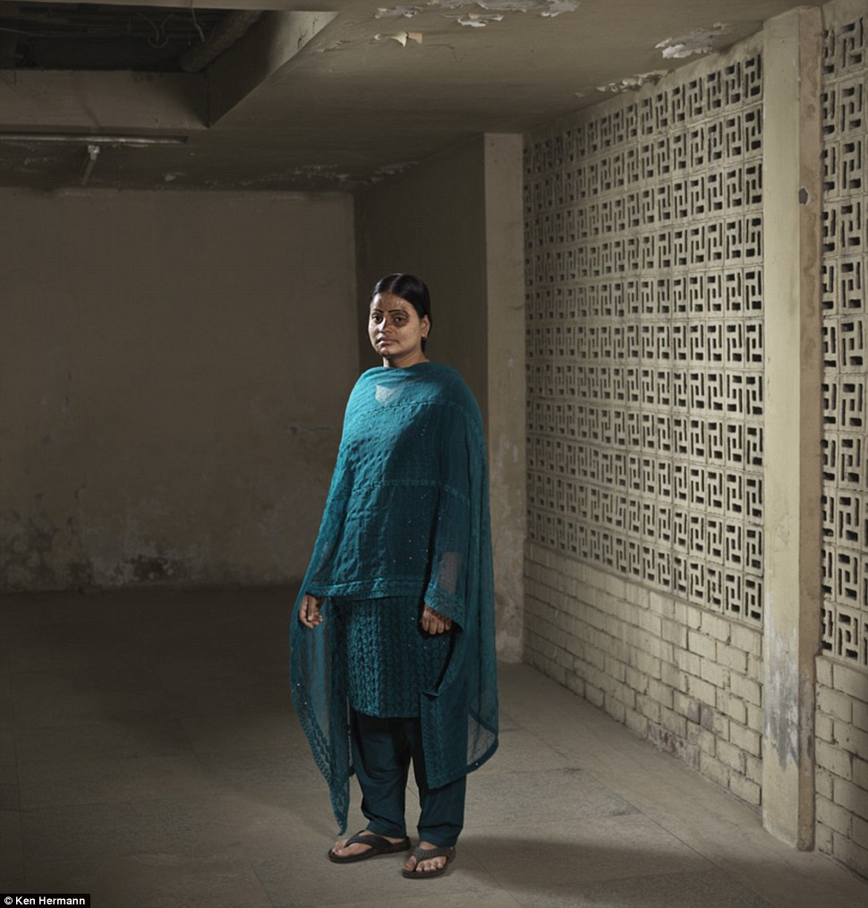 Жители Бангладеш, облитые кислотой, рассказывают о причинах своих ужасных увечий Бангладеш кислота, Кен Германн Ken Hermann, люди облитые кислотой