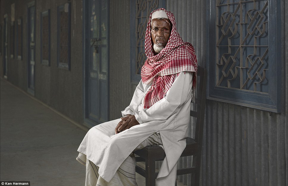 Жители Бангладеш, облитые кислотой, рассказывают о причинах своих ужасных увечий Бангладеш кислота, Кен Германн Ken Hermann, люди облитые кислотой