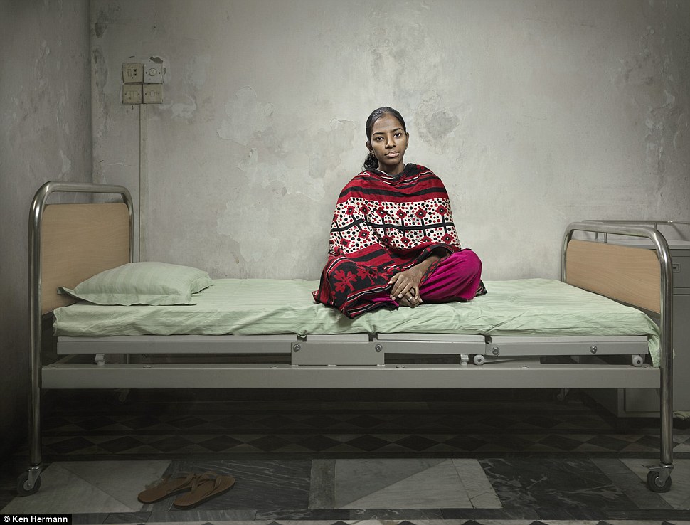 Жители Бангладеш, облитые кислотой, рассказывают о причинах своих ужасных увечий Бангладеш кислота, Кен Германн Ken Hermann, люди облитые кислотой