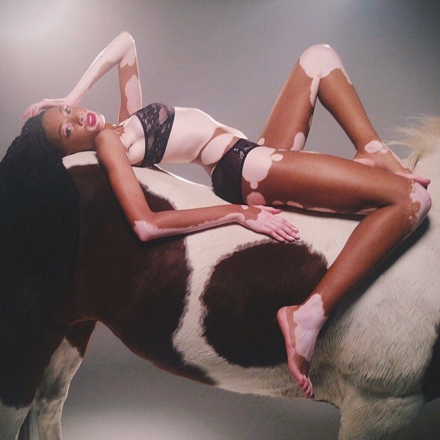 Chantelle Winnie, Шантель Винни, модель с нарушением пигментации кожи, Chantelle Winnie