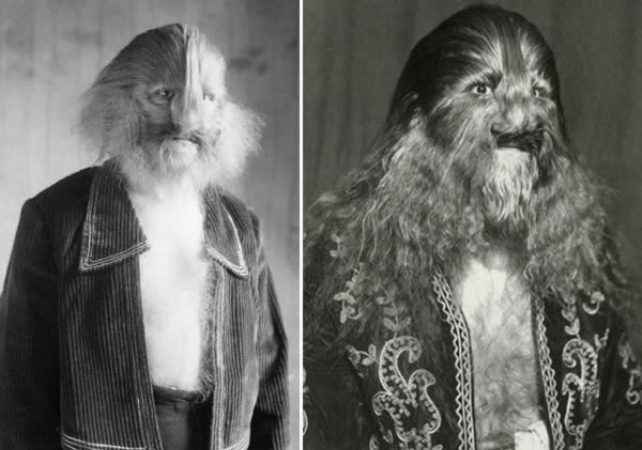 фрик-шоу, цирк уродов, физические дефекты, винтажные фотографии