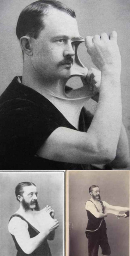 фрик-шоу, цирк уродов, физические дефекты, винтажные фотографии