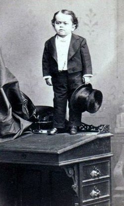 фрик-шоу, цирк уродов, физические дефекты, винтажные фотографии