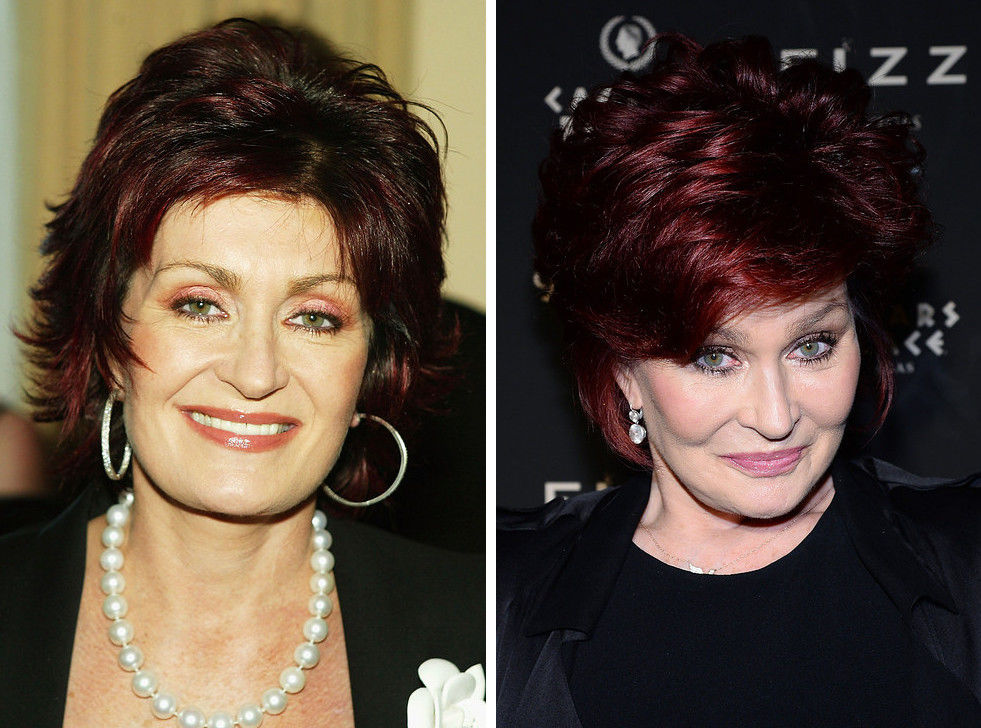 знаменитости стали выглядеть лучше, звезды с возрастом лучше, помолодевшие знаменитости