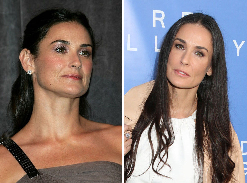 знаменитости стали выглядеть лучше, звезды с возрастом лучше, помолодевшие знаменитости