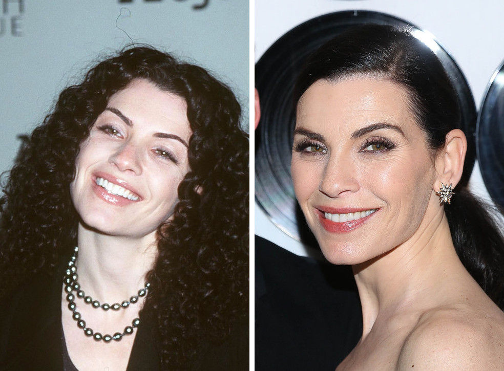 знаменитости стали выглядеть лучше, звезды с возрастом лучше, помолодевшие знаменитости