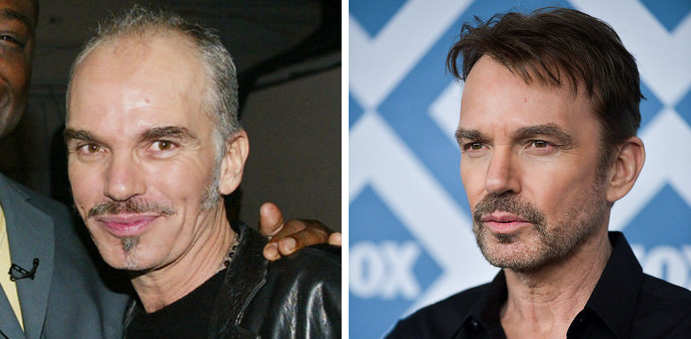 знаменитости стали выглядеть лучше, звезды с возрастом лучше, помолодевшие знаменитости