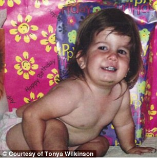 Hannah Wilkinson Prader-Willi syndrome, Ханна Уилкинсон синдром Прадера-Вилли