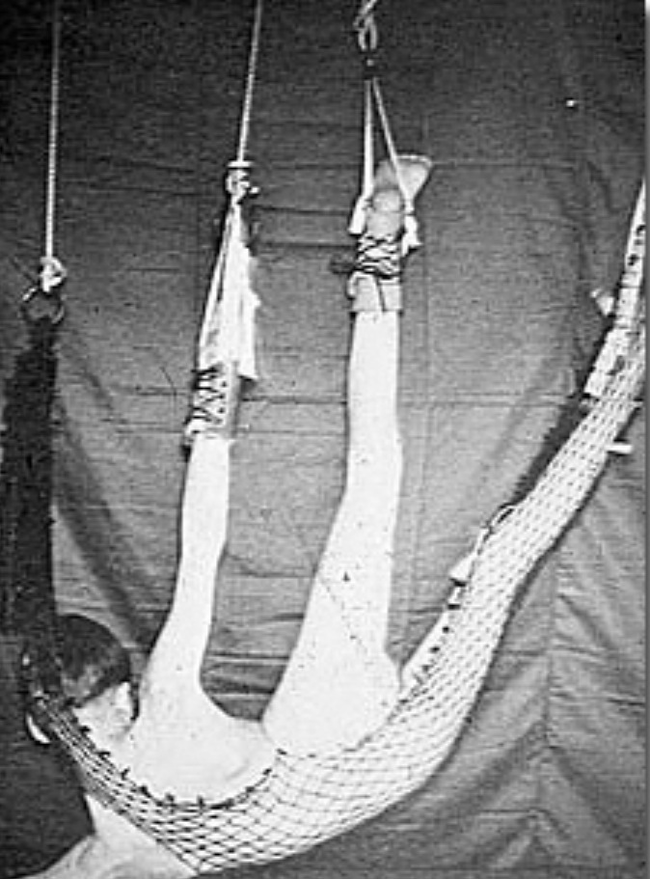 Сумасшедшие способы лечения, в существование которых трудно поверить Сумасшедшие способы лечения, страшные методы лечения, необычное лечение