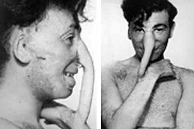 Сумасшедшие способы лечения, в существование которых трудно поверить Сумасшедшие способы лечения, страшные методы лечения, необычное лечение