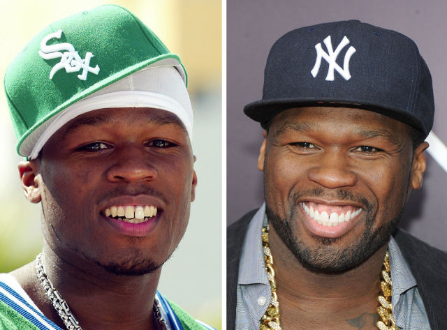 зубы звёзд, зубы знаменитостей до и после