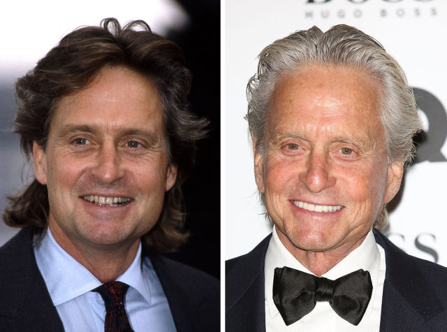 зубы звёзд, зубы знаменитостей до и после