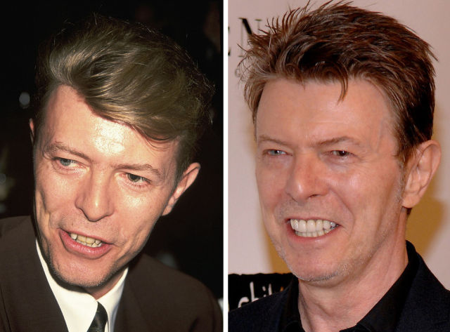 зубы звёзд, зубы знаменитостей до и после