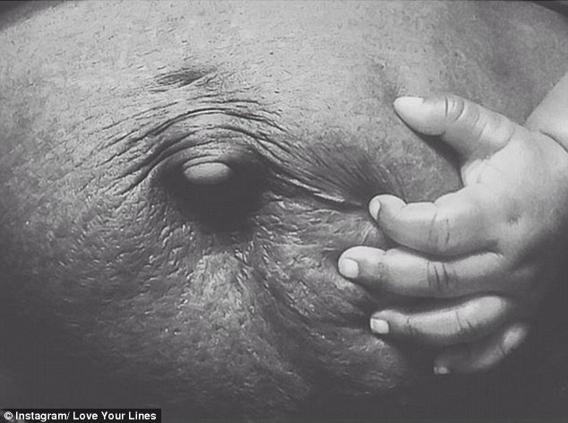 Instagram Love Your Lines, инстаграм растяжки, полюби свои растяжки