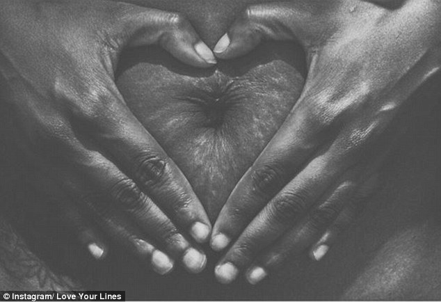 Instagram Love Your Lines, инстаграм растяжки, полюби свои растяжки