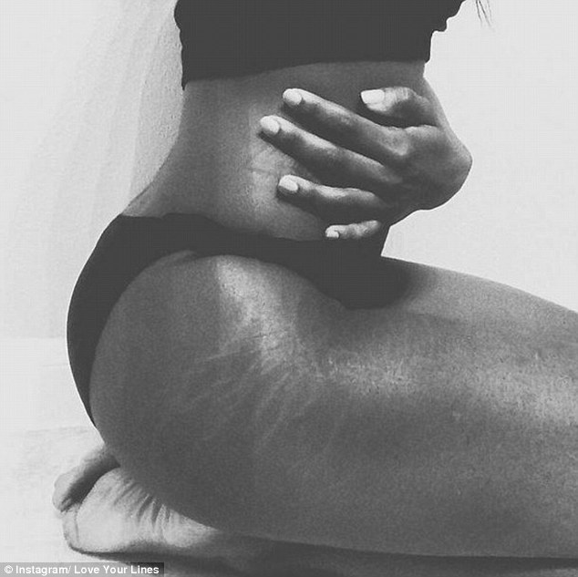 Instagram Love Your Lines, инстаграм растяжки, полюби свои растяжки